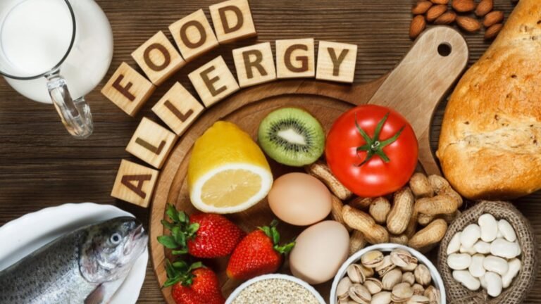 How to Identify Common Food Allergies