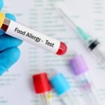 Why Food Allergy Testing Is Crucial