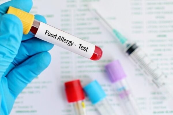 Why Food Allergy Testing Is Crucial